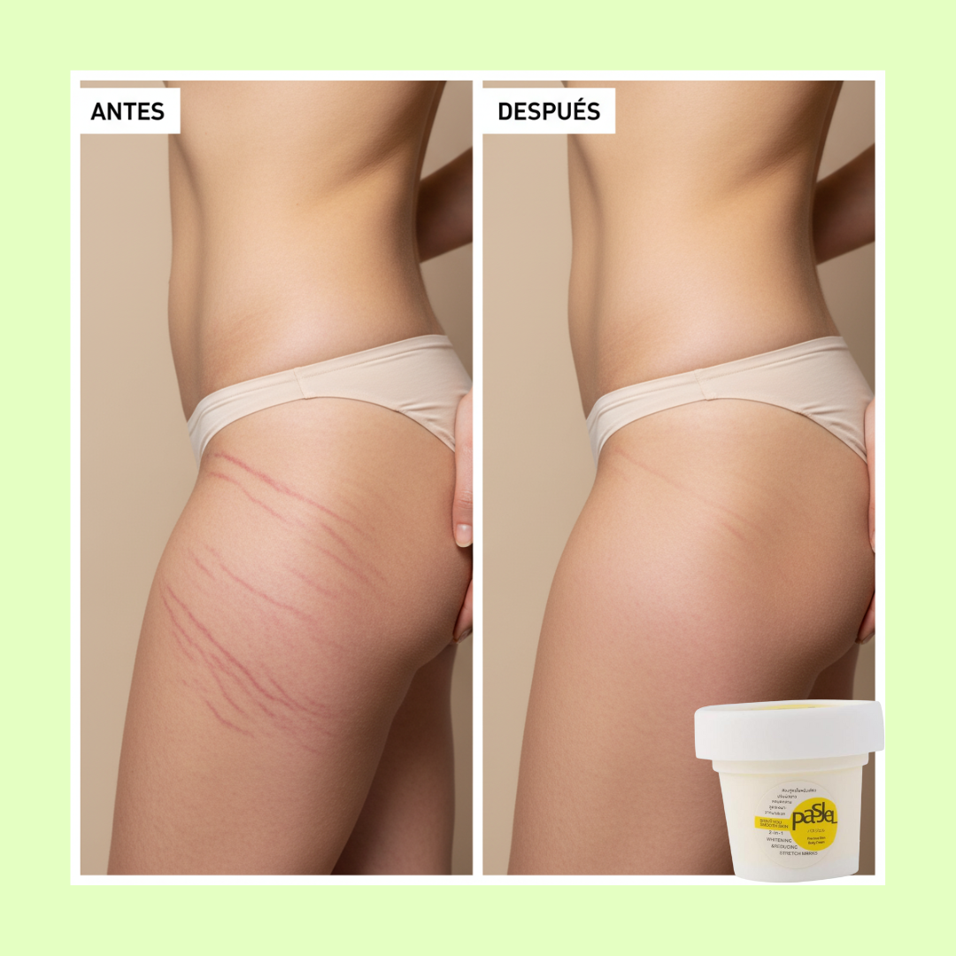CREMA DESVANECEDORA DE ESTRÍAS REPARACIÓN RÁPIDA + CREMA ELIMINADORA DE VARICES