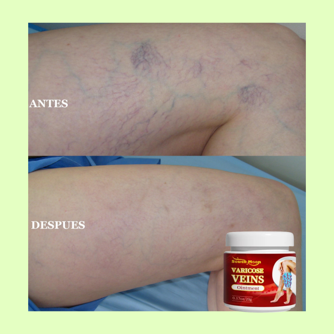 CREMA DESVANECEDORA DE ESTRÍAS REPARACIÓN RÁPIDA + CREMA ELIMINADORA DE VARICES