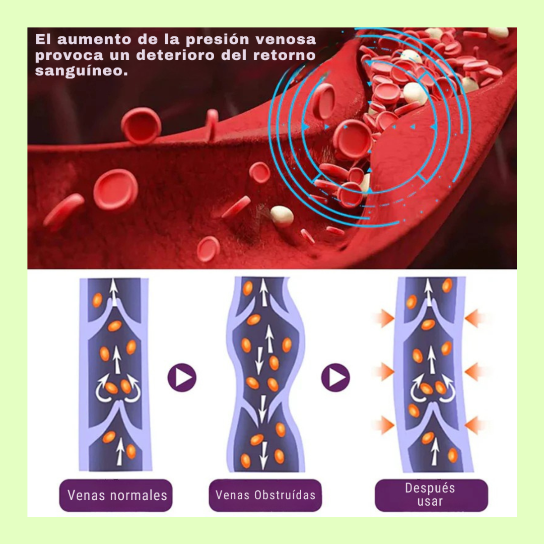 CREMA DESVANECEDORA DE ESTRÍAS REPARACIÓN RÁPIDA + CREMA ELIMINADORA DE VARICES