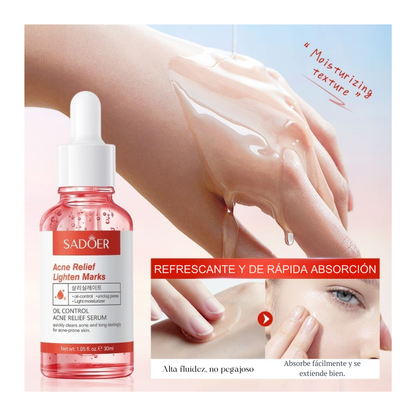 SÉRUM REPARADOR DE PIEL CON ACNÉ Y CICATRICES SADOER® ¡OFERTA 2x1 SOLO POR HOY!